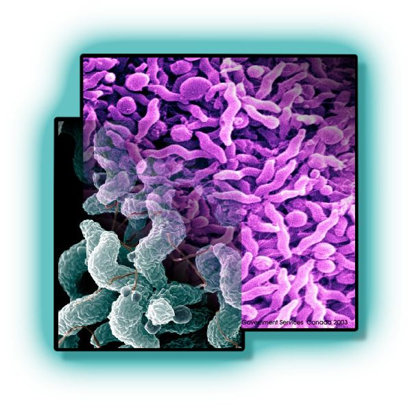 File:Campylobacter.jpg