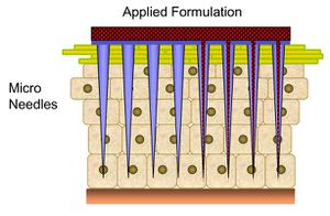 Microneedles for drug deliverySource
